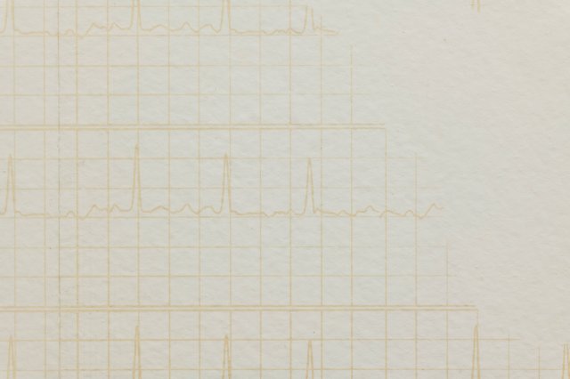 love, lust & coincidence (for those without the words) og barrier